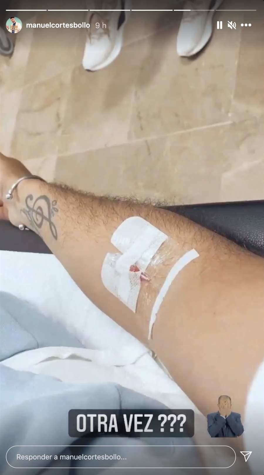 La vía del brazo de Manuel Cortés/ Foto: Instagram