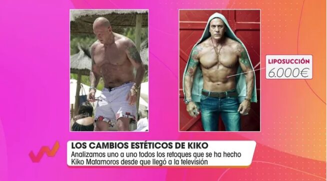 Algunos de los retoques estéticos de Kiko Matamoros/ Foto: telecinco.es