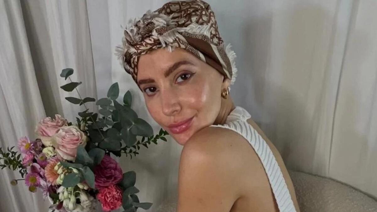 Aylén Milla hizo público su cáncer de mama a través de las redes | Foto: Instagram