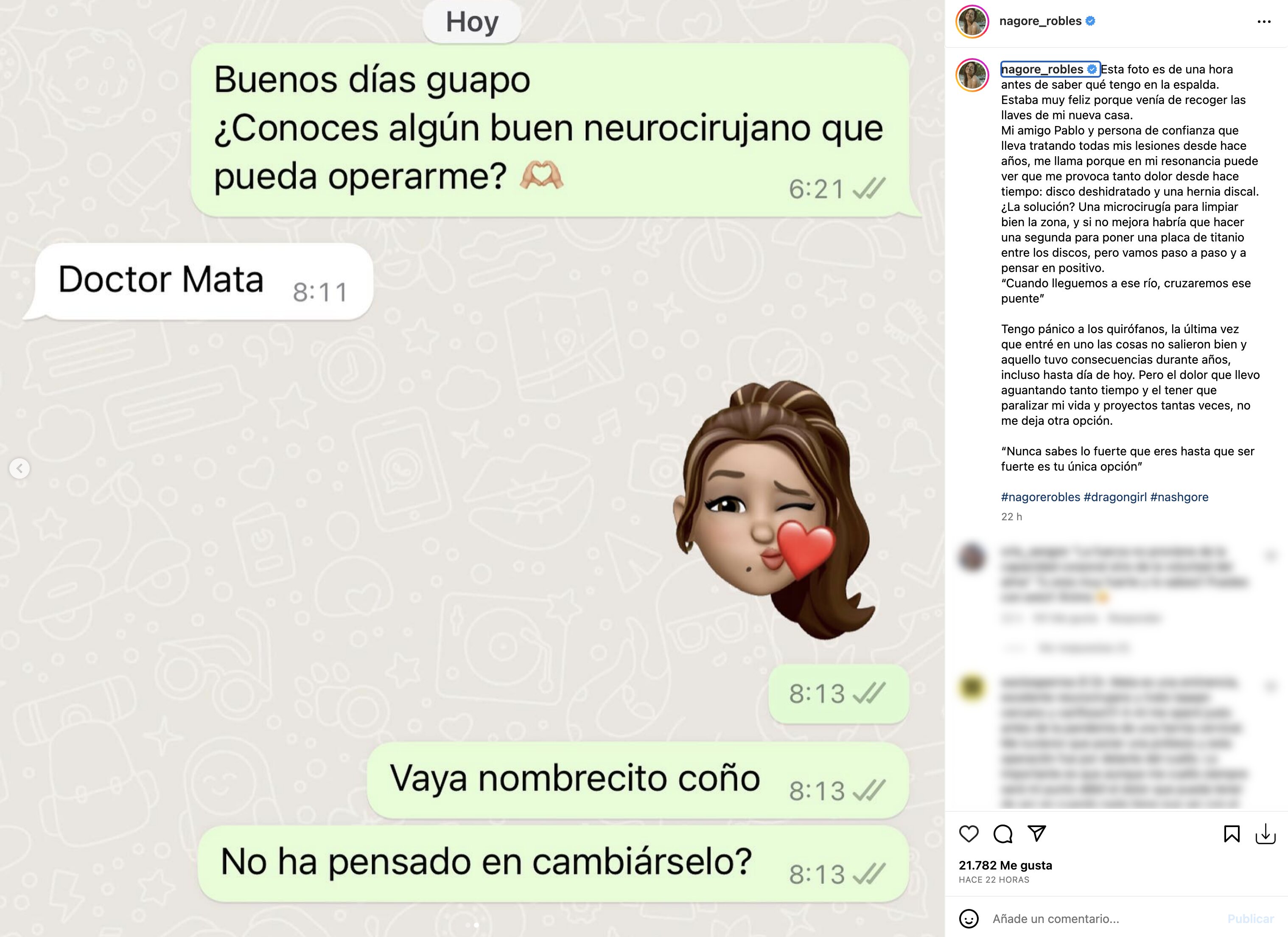 Nagore Robles tendrá que pasar por quirófano por unos problemas de espalda | Foto: Instagram