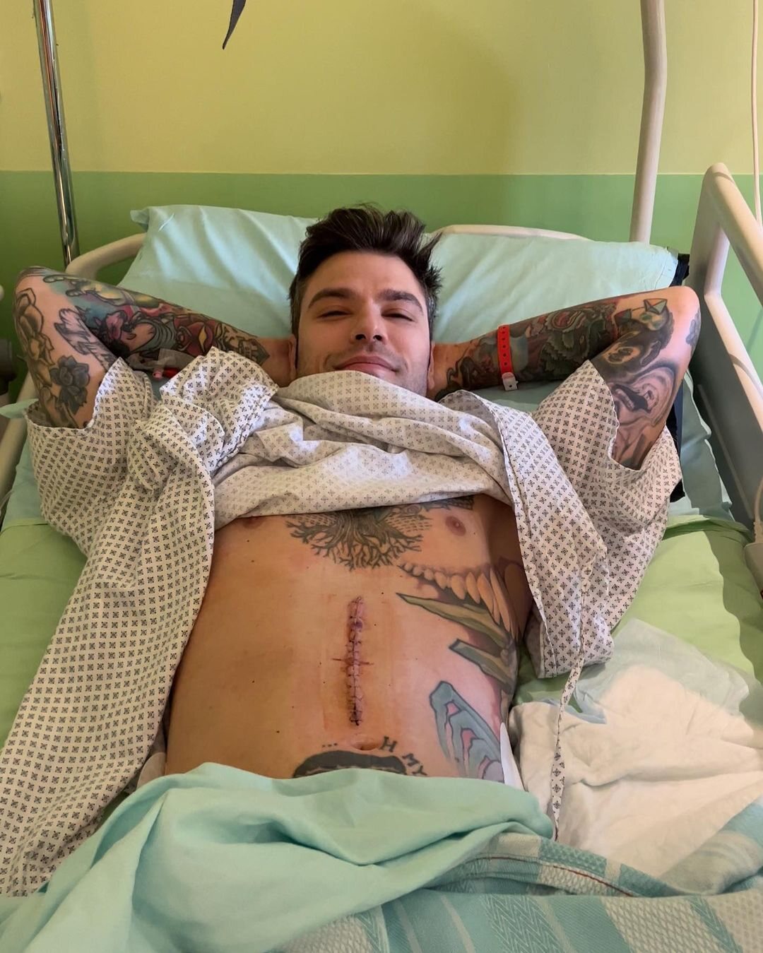 Fedez tras su operación de cáncer de páncreas | Foto: Instagram