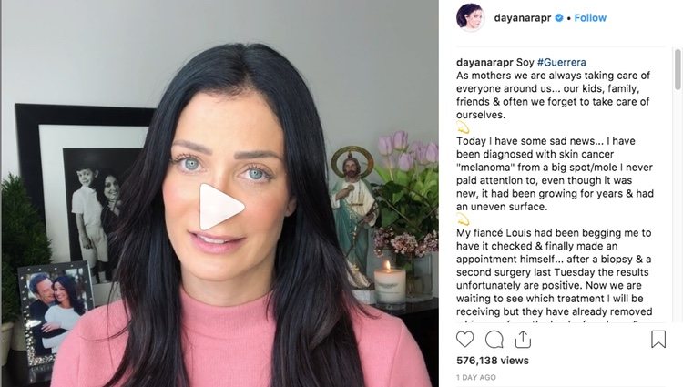 Dayanara Torres explica su cáncer de piel