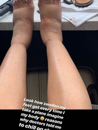 Fotografía de los pies de Cardi B. Instagram Cardi B