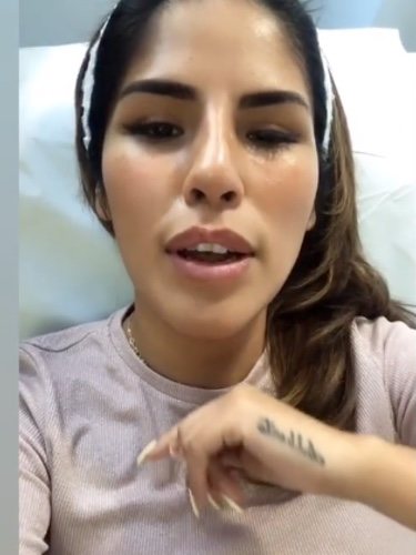 Chabelita Pantoja mostrando su nuevo retoque estético en 'stories' de Instagram / Foto: Instagram @isapantojam