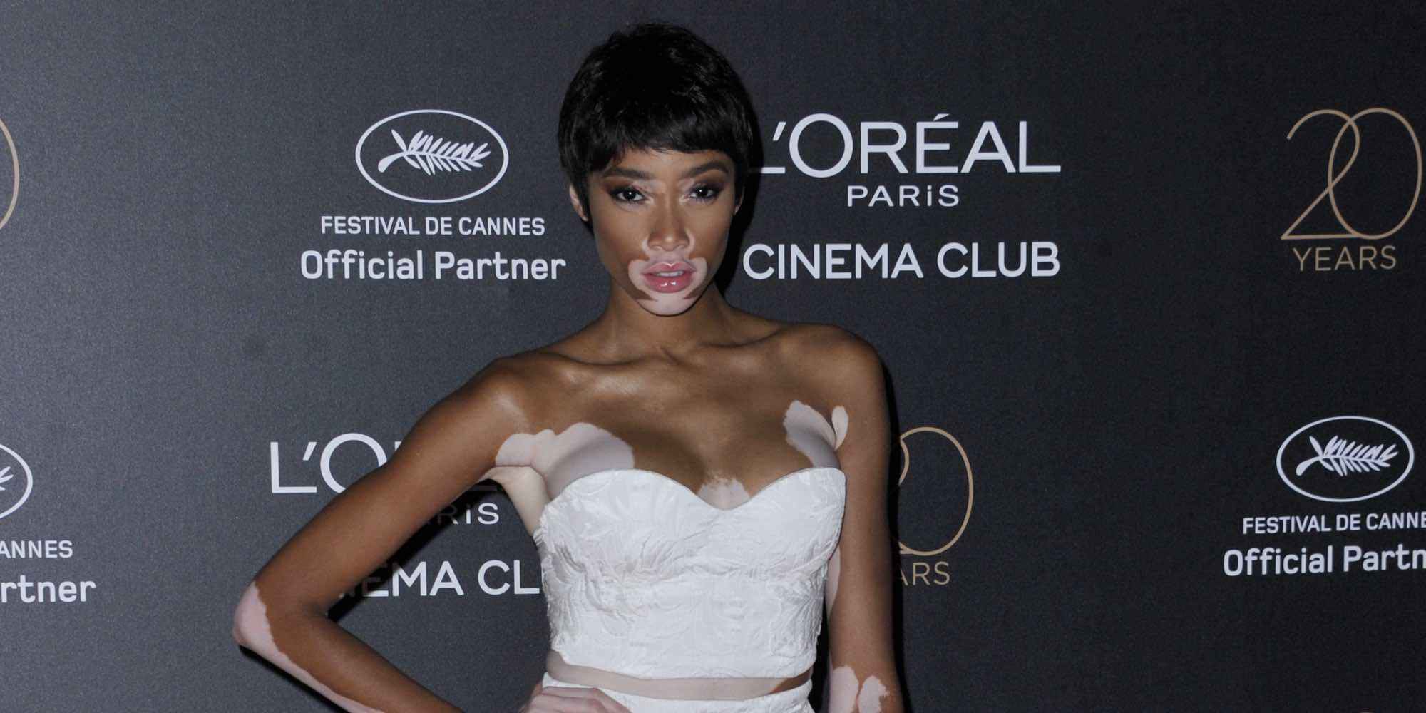 El descuido de Winnie Harlow en Cannes 2017 al dejar al descubierto su ropa interior