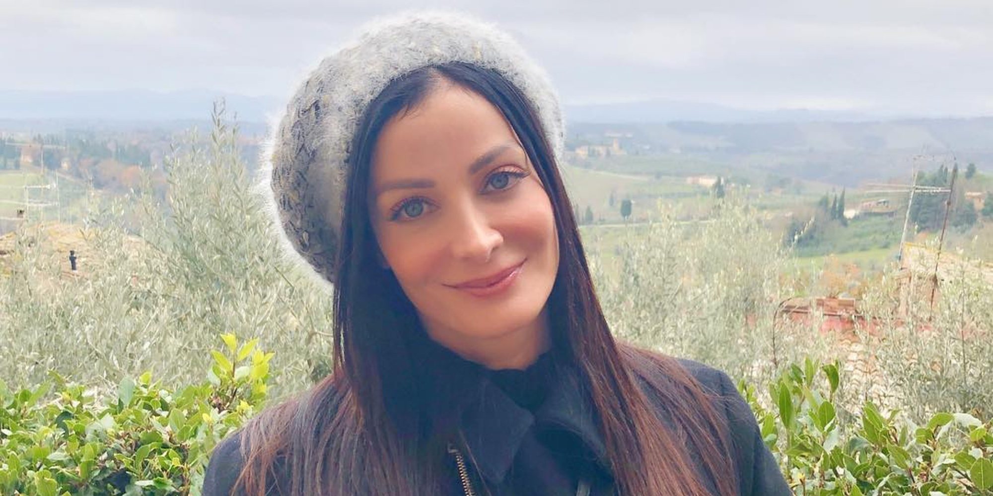 Dayanara Torres desvela que sufre cáncer de piel por no prestar atención a un lunar