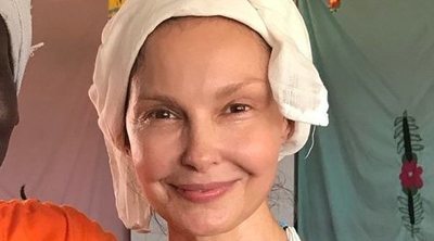 Ashley Judd enseña las imágenes de su traslado cuando casi pierde la pierna en el Congo