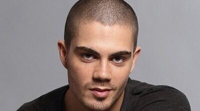 Max George de The Wanted muestra las secuelas de un accidente de buceo y da un consejo para evitarlo