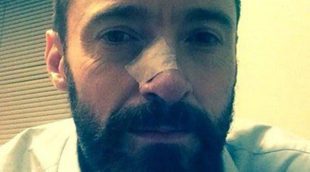 Hugh Jackman pasa de nuevo por el quirófano para operarse de un carcinoma