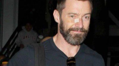 Hugh Jackman afirma que en un futuro podría continuar con sus problemas en la piel