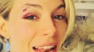 Sienna Miller se hiere en un ojo en un espectáculo de Broadway