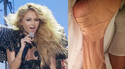 Paulina Rubio muestra las consecuencias de su impresionante caída durante su concierto en México