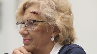 Manuela Carmena reaparece con una brecha en la cabeza tras su accidente doméstico