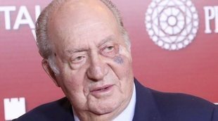 El Rey Juan Carlos, operado de un carcinoma basocelular