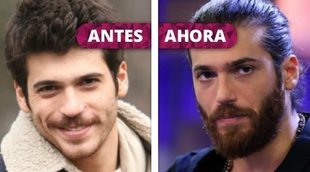 Así ha cambiado Can Yaman: La metamorfosis del actor de 'Dolunay: Luna llena' y 'Erkenci Kus: Pájaro soñador'