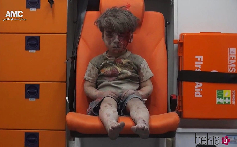 Omran Daqneesh inmóvil después de sobrevivir a un bombardeo en Siria