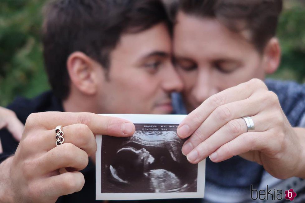 Tom Daley y Dustin Lance Black anuncian que van a ser padres