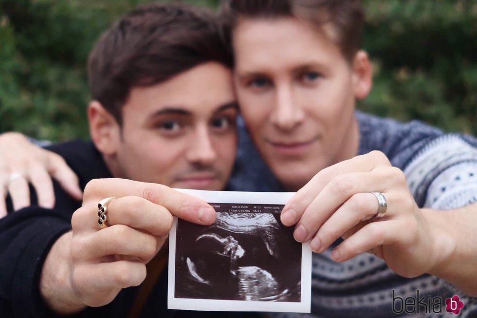 Tom Daley y Dustin Lance Black enseñando la ecografía de su primer hijo