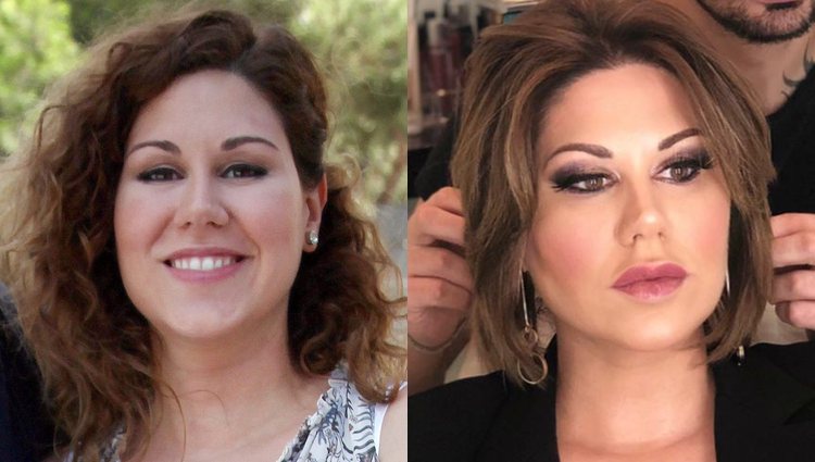 El antes y el después de la cantante Tamara