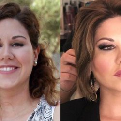 El antes y el después de la cantante Tamara