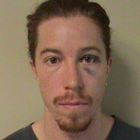 Shaun White detenido por escándalo público y vandalismo