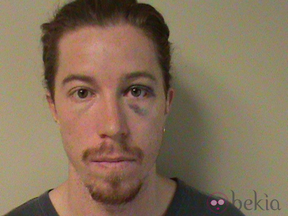 Shaun White detenido por escándalo público y vandalismo