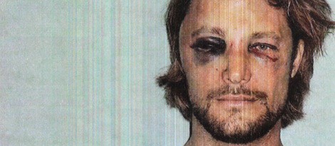 Gabriel Aubry muestra su rostro tras la pelea con Olivier Martínez