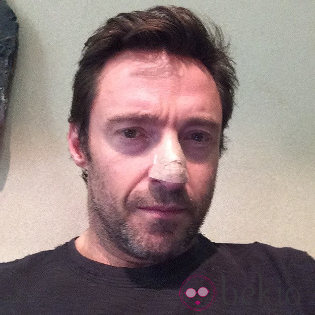 Hugh Jackman se cubre el cancer de piel