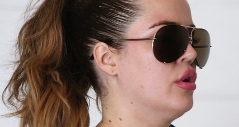 Khloé Kardashian con unos labios extraños por Los Ángeles