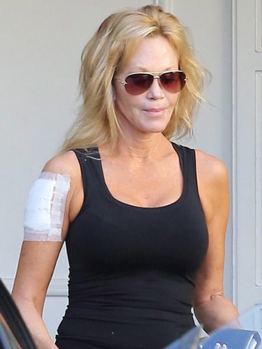 Melanie Griffith sale de una clínica tras quitarse el tatuaje dedicado a Antonio Banderas