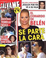 El exmarido de Belén Esteban se parte la cara en Sálvame