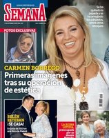 Las primeras imágenes de Carmen Borrego después de su operación estética en Semana